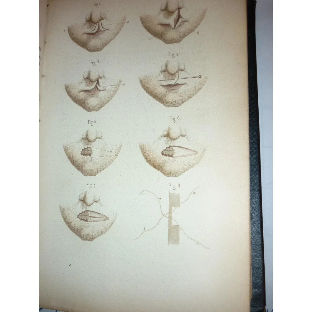 N/A antique medical